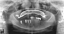 %_tempFileNameImplant%2031k2%