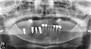 %_tempFileNameImplant%2031k3%