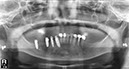 %_tempFileNameImplant%2031k4%