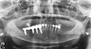 %_tempFileNameImplant%2031k5%
