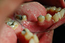 %_tempFileNameImplant%2032La1%