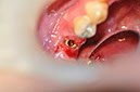 %_tempFileNameImplant%2032La3%