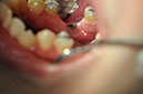 %_tempFileNameImplant%2032La4%