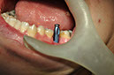%_tempFileNameImplant%2032La5%