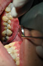 %_tempFileNameImplant%2032La7%
