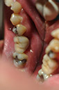 %_tempFileNameImplant%2032La8%