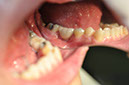 %_tempFileNameImplant%2032La9%
