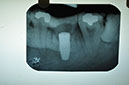 %_tempFileNameImplant%2032Lb1%