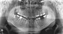 %_tempFileNameImplant%2032Lc1%