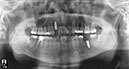 %_tempFileNameImplant%2032Lc2%