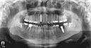 %_tempFileNameImplant%2032Lc3%