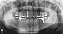 %_tempFileNameImplant%2032Lc4%