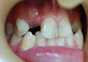 %_tempFileNameImplant%2032a1%