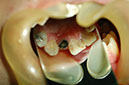 %_tempFileNameImplant%2032a2%