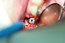 %_tempFileNameImplant%2032c2%