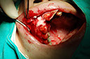 %_tempFileNameImplant%2032c3%