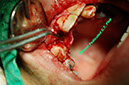 %_tempFileNameImplant%2032d1%