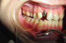 %_tempFileNameImplant%2032e2%