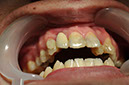 %_tempFileNameImplant%2032e5%