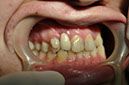 %_tempFileNameImplant%2032e6%