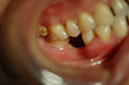 %_tempFileNameImplant%2033a%