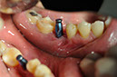 %_tempFileNameImplant%2033b%