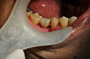 %_tempFileNameImplant%2033c%