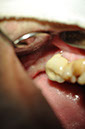 %_tempFileNameImplant%2034a%