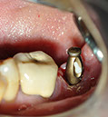 %_tempFileNameImplant%2034d%