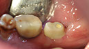 %_tempFileNameImplant%2034e%