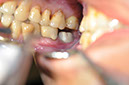%_tempFileNameImplant%2034f%
