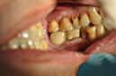 %_tempFileNameImplant%2034g%