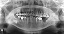 %_tempFileNameImplant%2034h1%