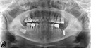 %_tempFileNameImplant%2034h2%