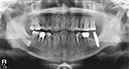 %_tempFileNameImplant%2034h3%