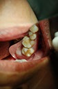 %_tempFileNameImplant%2035a%