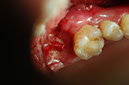 %_tempFileNameImplant%2035b%