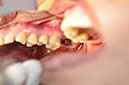 %_tempFileNameImplant%2035c%