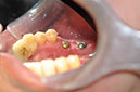 %_tempFileNameImplant%2036a2%