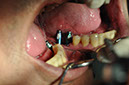 %_tempFileNameImplant%2036a3%