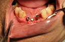 %_tempFileNameImplant%2036a4%