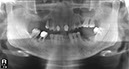 %_tempFileNameImplant%2036b1%