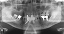 %_tempFileNameImplant%2036b3%