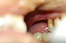 %_tempFileNameImplant%2037a1%