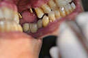 %_tempFileNameImplant%2037a3%