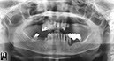%_tempFileNameImplant%2037b1%