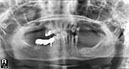 %_tempFileNameImplant%2037b2%