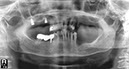%_tempFileNameImplant%2037b3%