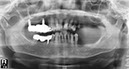 %_tempFileNameImplant%2037b4%