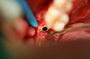 %_tempFileNameImplant%2039b%